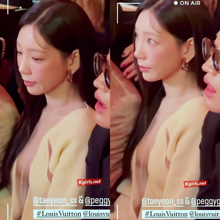 태연 사이드붑 실루엣이 살짝.. 4